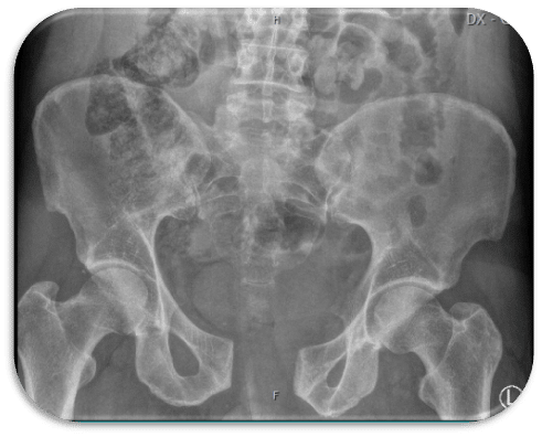 ESTES Interdisciplinary Pelvic Course